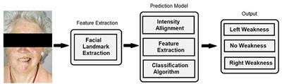 Human vs. Machine Learning Based Detection of Facial Weakness Using Video Analysis